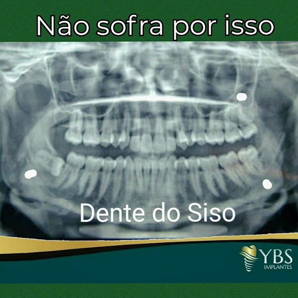 Foto de YBS Implantes