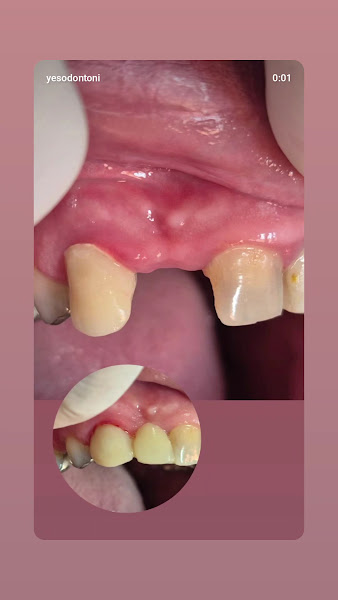 Foto 3 de Yes Odonto Nova Iguaçu