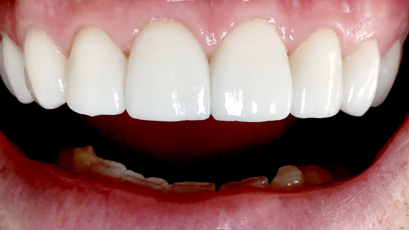 Foto 2 de Zenith arte e saude odontologia alphaville dentista