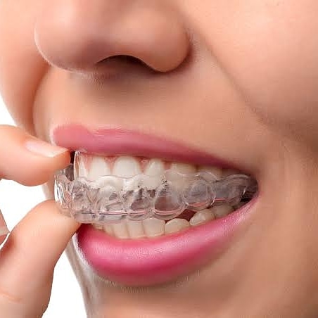 Foto 2 de Zimbro Odontologia