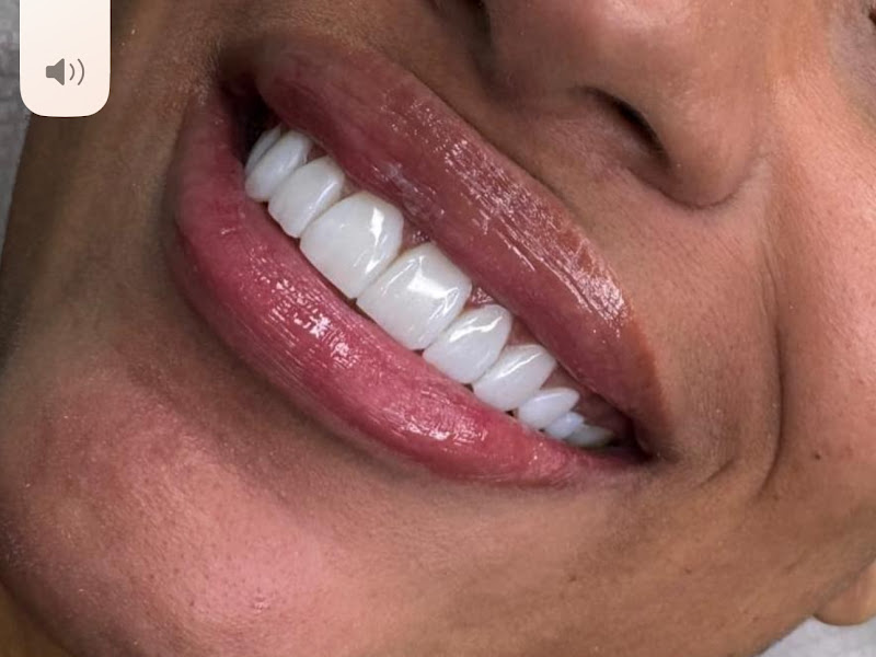 Foto 5 de ZN Facetas