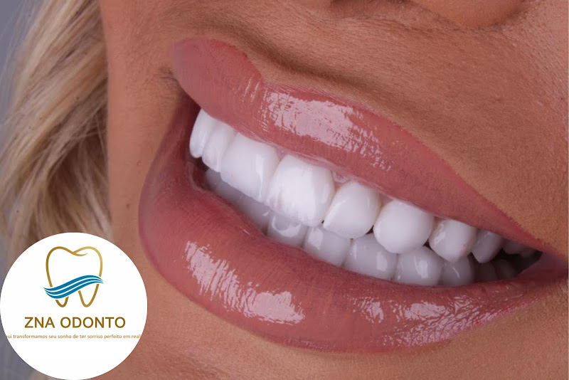 Foto 3 de ZNA Odonto | Implante | Aparelho dental