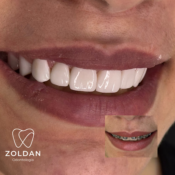 Foto 3 de Zoldan Odontologia